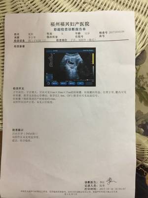 帶著7周的B超進(jìn)來猜猜男女吧!