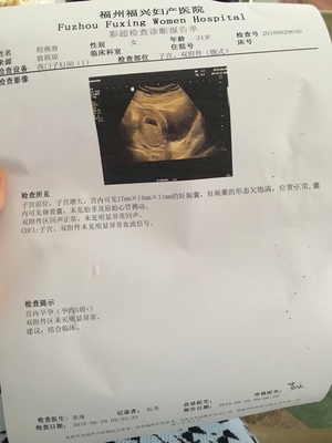 好擔(dān)心。怎么辦