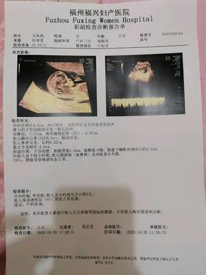 福州福興婦產(chǎn)醫(yī)院 NT檢查與胎兒性別的關(guān)系