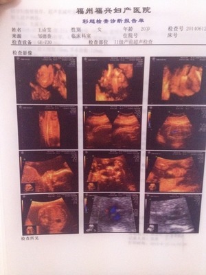 福州媽媽圈熱議 看看是男是女，福興婦產(chǎn)醫(yī)院的科學(xué)性別鑒定指南